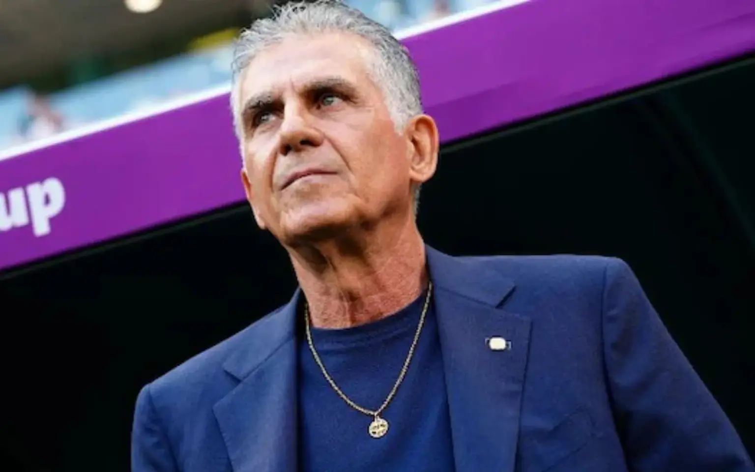 کارلوس کی روش در کت و شلوار